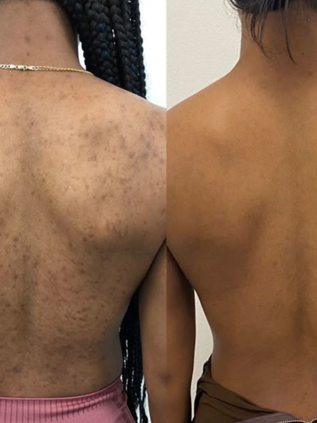Brighten + Correct (Hyperpigmentation Focus)