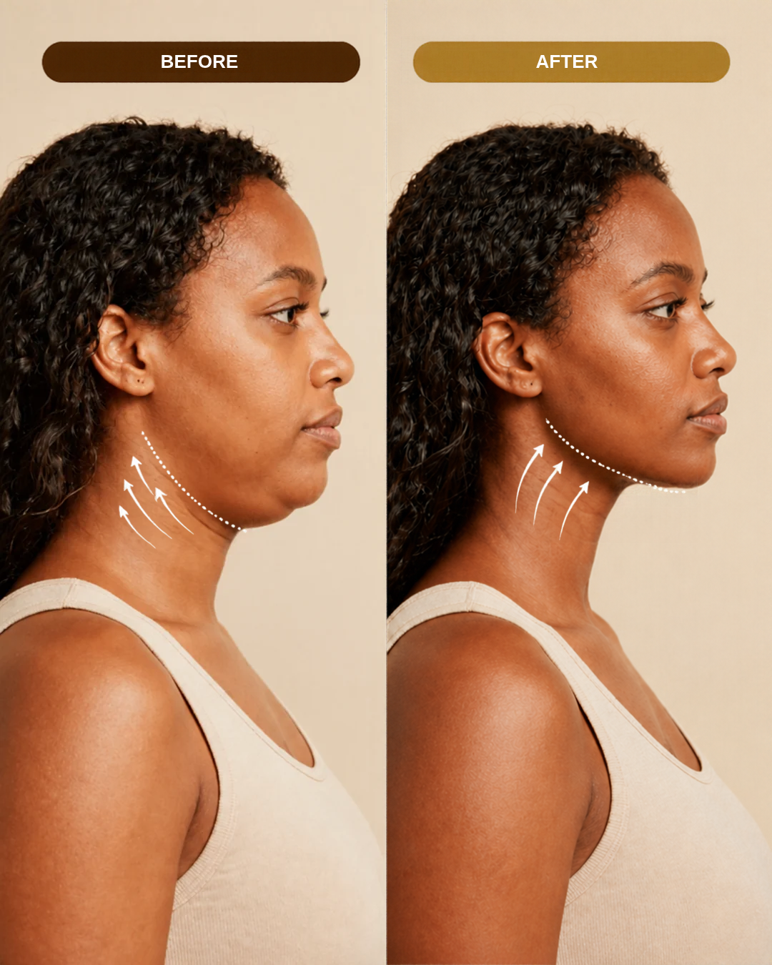 Advanced Face & Neck Tightening & Lifting Massager