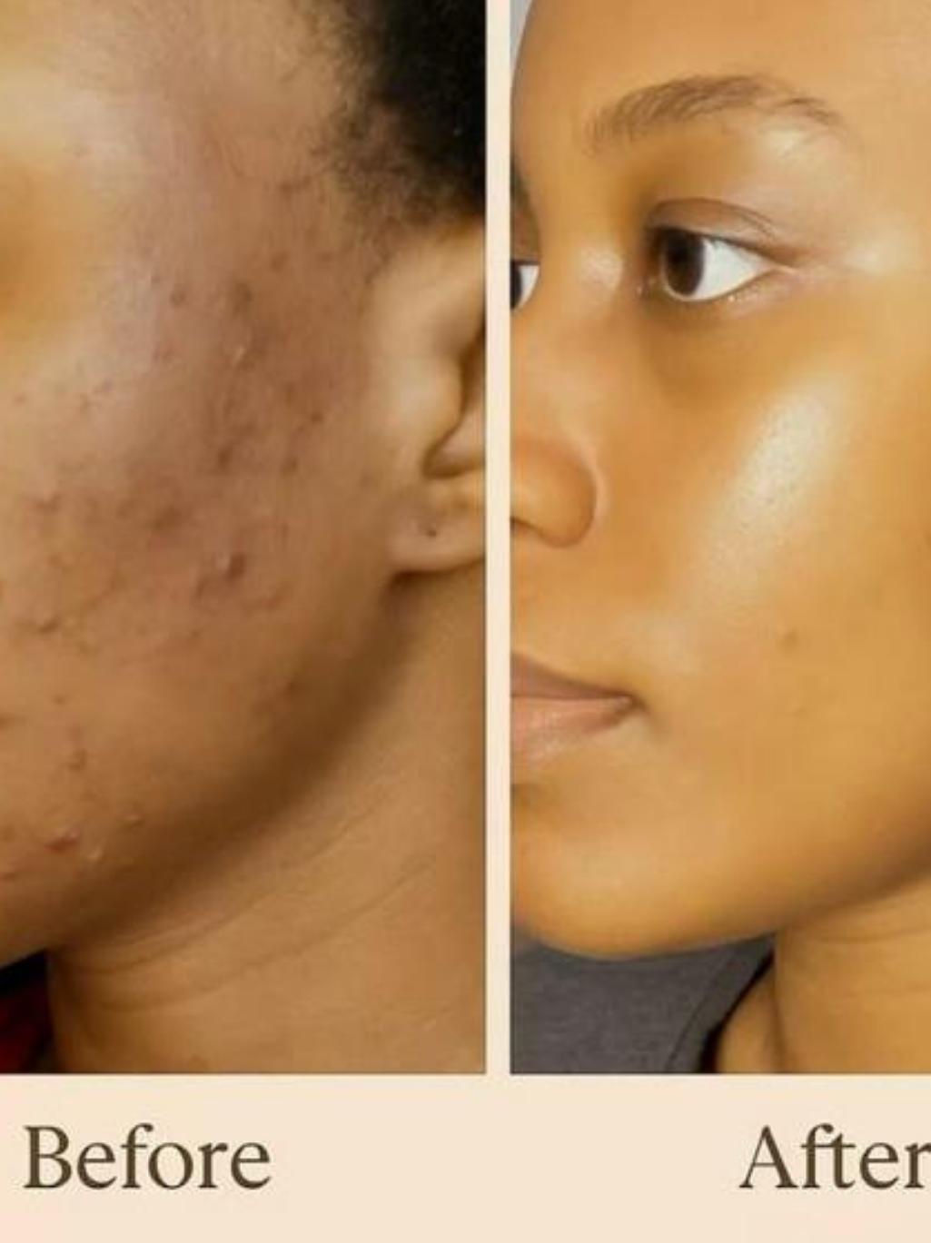 7% GLYCOLIC ACID TONER